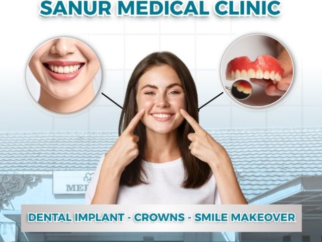 Prosthodontist in Bali | Dental Implants, Crowns & Smile Makeover  At Sanur Medical Clinic